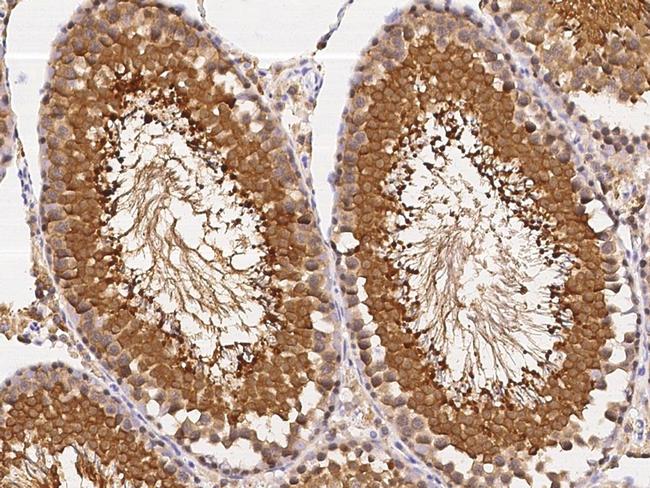 UCHL3 Antibody in Immunohistochemistry (Paraffin) (IHC (P))