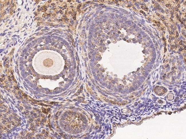 WFDC2 Antibody in Immunohistochemistry (Paraffin) (IHC (P))