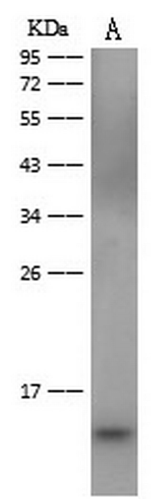 Dengue Virus Type 2 Envelope (Domain III) (strain New Guinea C/PUO-218 hybrid) Antibody in Western Blot (WB)