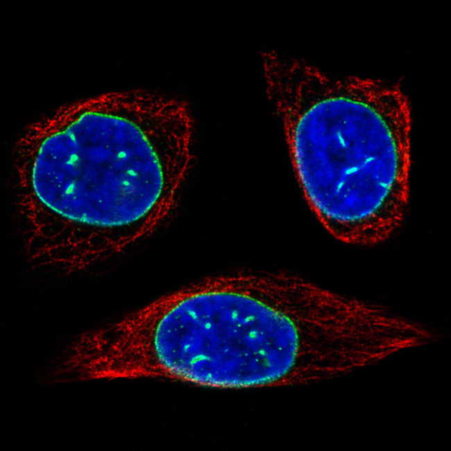 Emerin Antibody in Immunocytochemistry (ICC/IF)