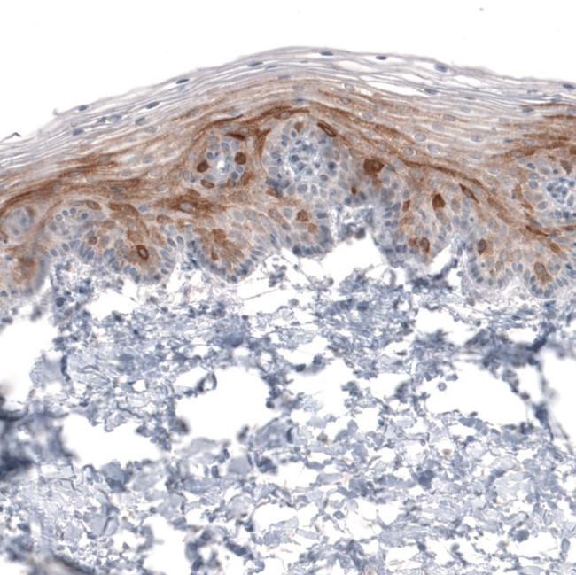 HMGCR Antibody in Immunohistochemistry (Paraffin) (IHC (P))