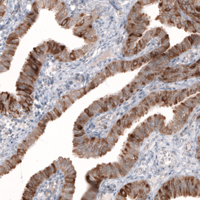 HMGCR Antibody in Immunohistochemistry (Paraffin) (IHC (P))