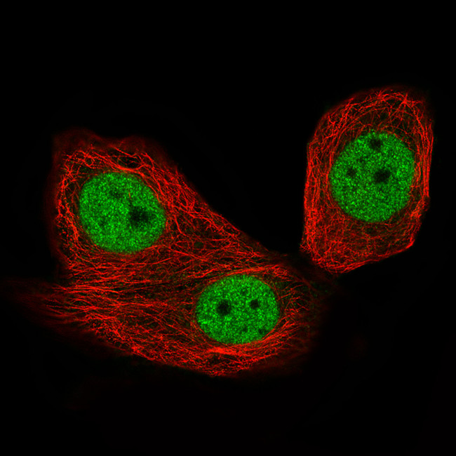 CTCF Antibody in Immunocytochemistry (ICC/IF)