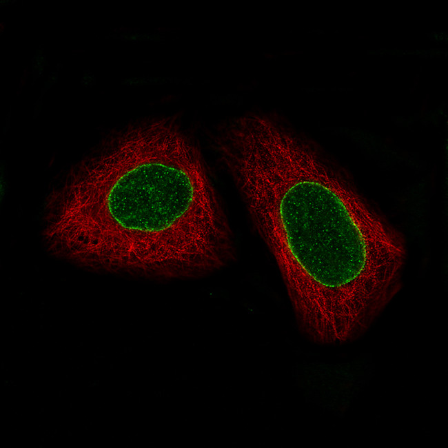 ERCC1 Antibody in Immunocytochemistry (ICC/IF)