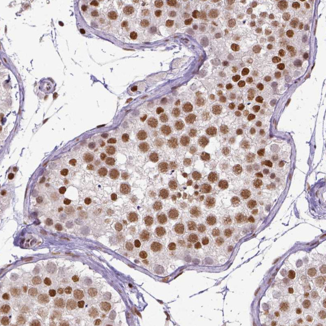 ERCC1 Antibody in Immunohistochemistry (Paraffin) (IHC (P))