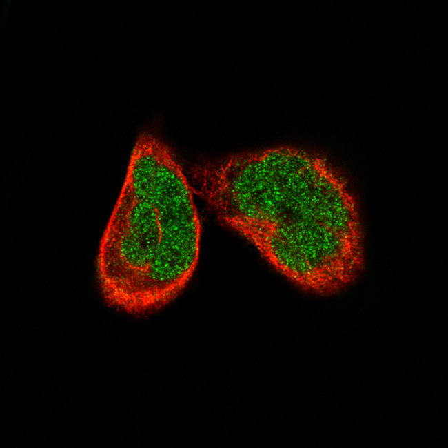 ATF3 Antibody in Immunocytochemistry (ICC/IF)