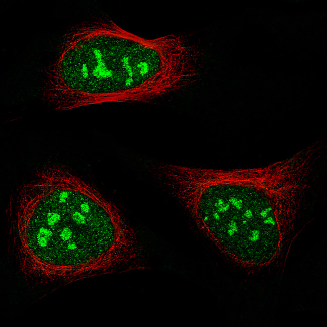 NIFK Antibody in Immunocytochemistry (ICC/IF)