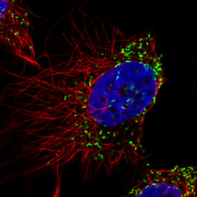 PMP70 Antibody in Immunocytochemistry (ICC/IF)