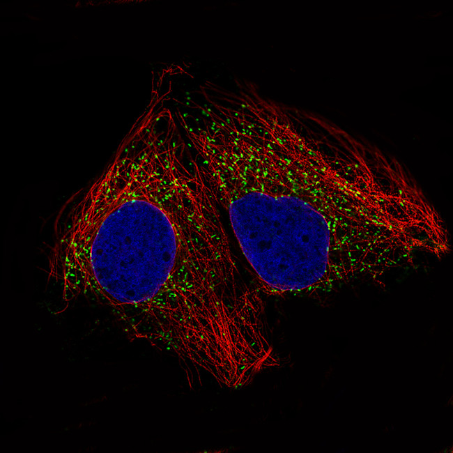 ACAA1 Antibody in Immunocytochemistry (ICC/IF)