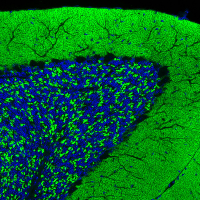 VGLUT1 Antibody in Immunohistochemistry (Paraffin) (IHC (P))