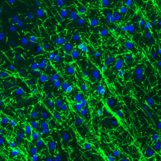 CNPase Antibody in Immunohistochemistry (Paraffin) (IHC (P))