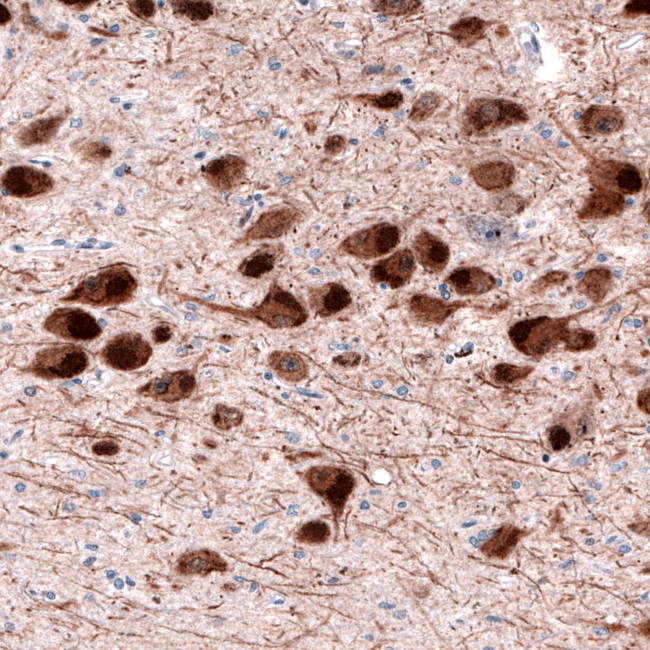 DOPA Decarboxylase Antibody in Immunohistochemistry (Paraffin) (IHC (P))