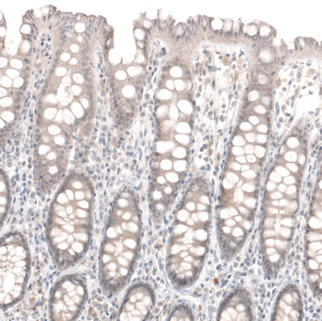 Laminin alpha-1 Antibody in Immunohistochemistry (Paraffin) (IHC (P))