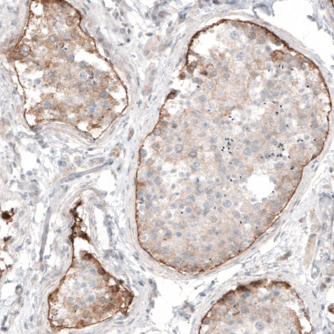 Laminin alpha-1 Antibody in Immunohistochemistry (Paraffin) (IHC (P))