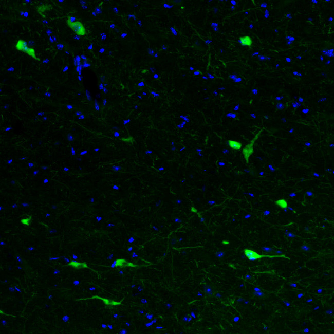 ChAT Antibody in Immunohistochemistry (Paraffin) (IHC (P))