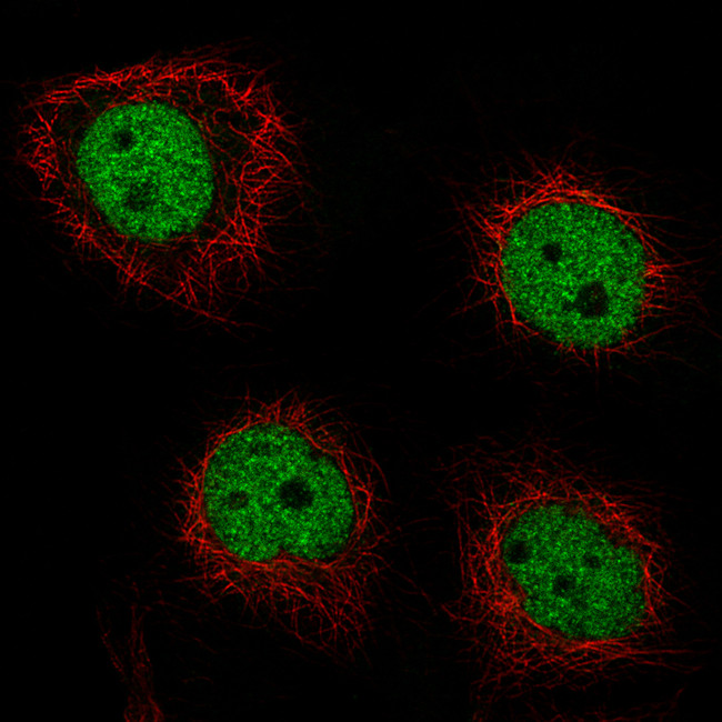 GRHL2 Antibody in Immunocytochemistry (ICC/IF)