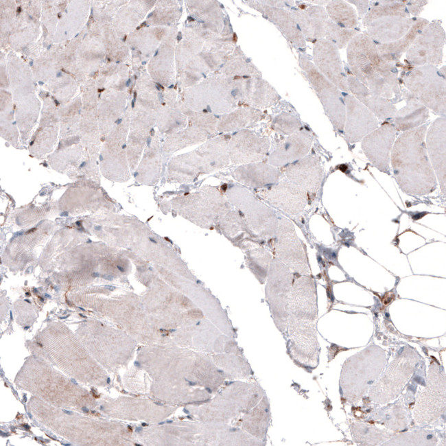 Cyclophilin B Antibody in Immunohistochemistry (Paraffin) (IHC (P))