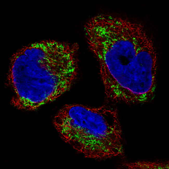 OTC Antibody in Immunocytochemistry (ICC/IF)