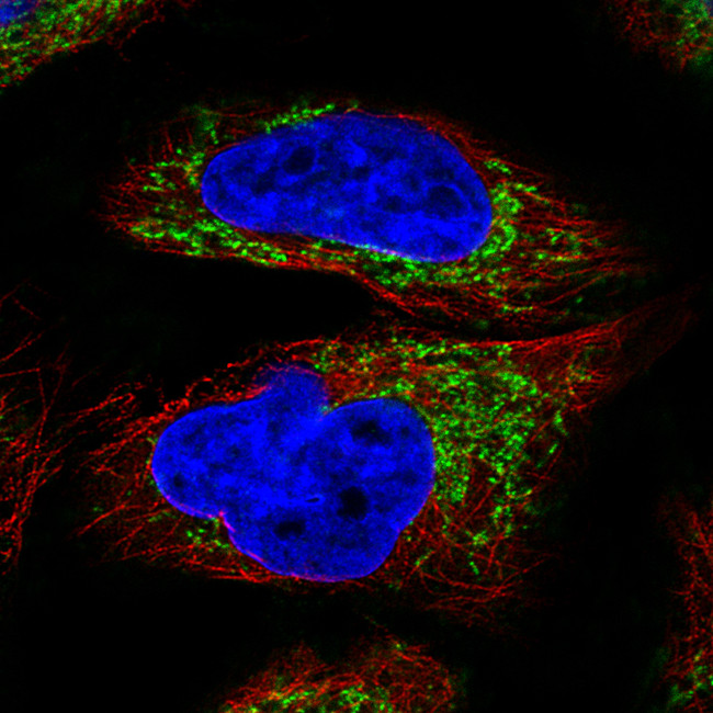 OTC Antibody in Immunocytochemistry (ICC/IF)