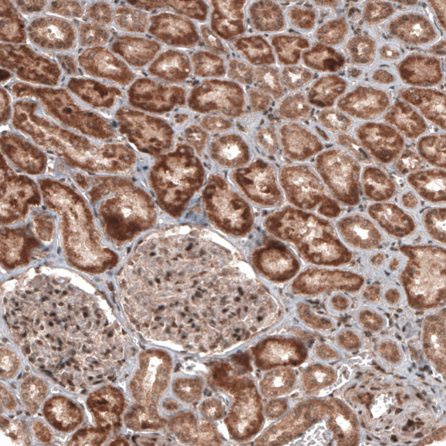 RBCK1 Antibody in Immunohistochemistry (Paraffin) (IHC (P))