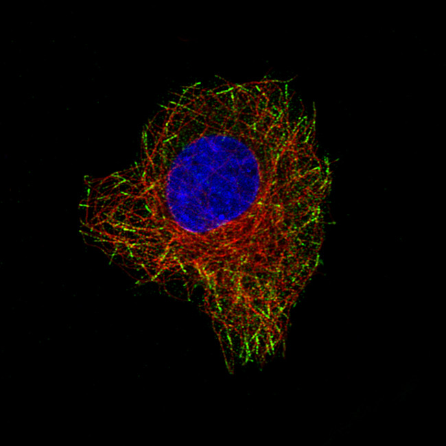 CLIP1 Antibody in Immunocytochemistry (ICC/IF)