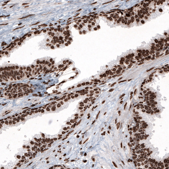 Histone H2B Antibody in Immunohistochemistry (Paraffin) (IHC (P))