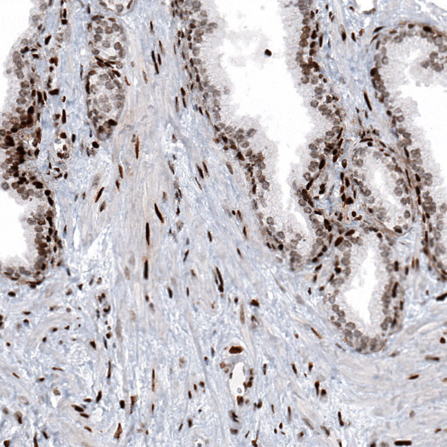 Histone H2B Antibody in Immunohistochemistry (Paraffin) (IHC (P))