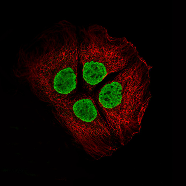 Histone Macro-H2A.1 Antibody in Immunocytochemistry (ICC/IF)