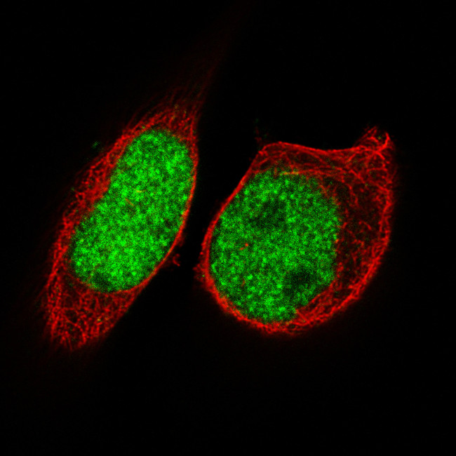 FOXP2 Antibody in Immunocytochemistry (ICC/IF)