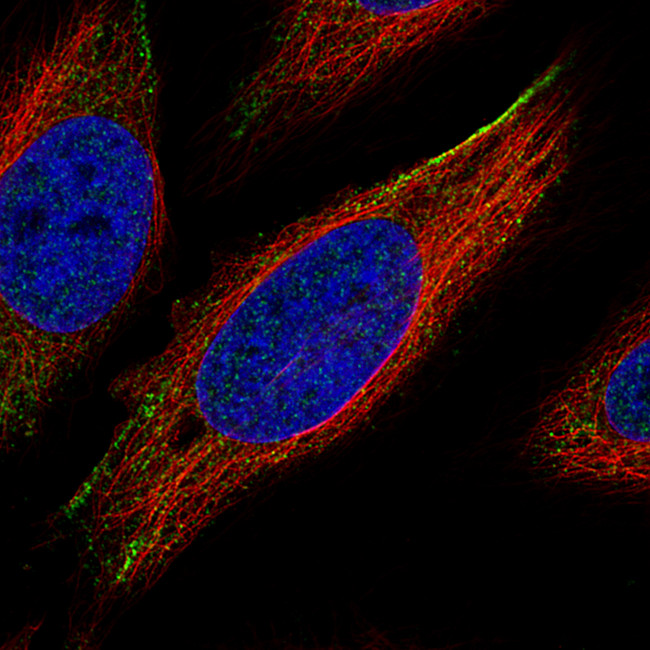 ROR2 Antibody in Immunocytochemistry (ICC/IF)