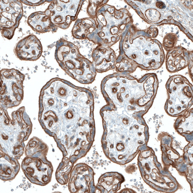 ITGA3 Antibody in Immunohistochemistry (Paraffin) (IHC (P))