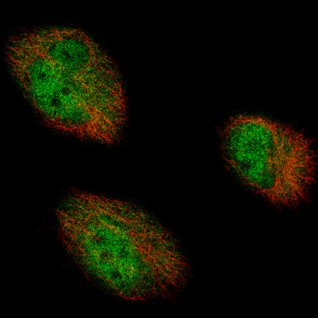 AUTS2 Antibody in Immunocytochemistry (ICC/IF)