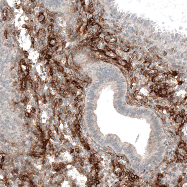 ITGA8 Antibody in Immunohistochemistry (Paraffin) (IHC (P))