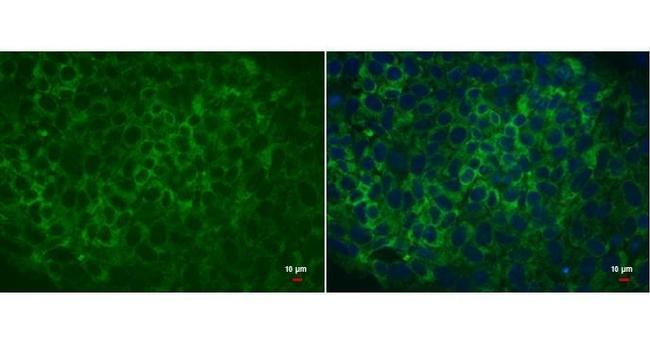 LIN28A Antibody in Immunocytochemistry (ICC/IF)