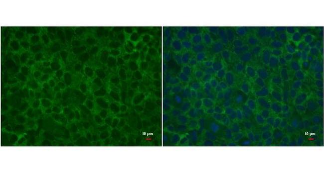 LIN28A Antibody in Immunocytochemistry (ICC/IF)