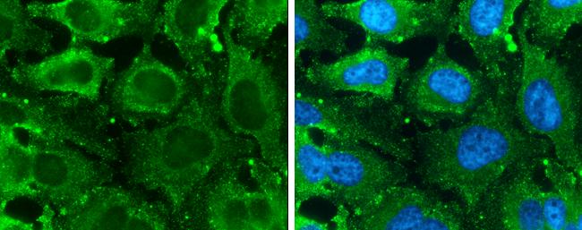 GLO1 Antibody in Immunocytochemistry (ICC/IF)