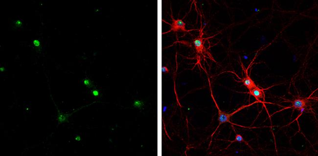 HMGB1 Antibody in Immunocytochemistry (ICC/IF)