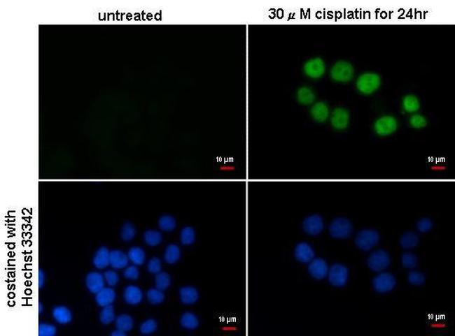 p21 Antibody in Immunocytochemistry (ICC/IF)