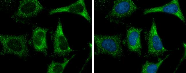 FASN Antibody in Immunocytochemistry (ICC/IF)