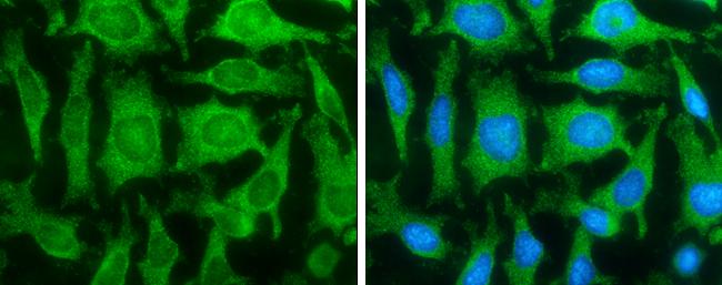 FASN Antibody in Immunocytochemistry (ICC/IF)