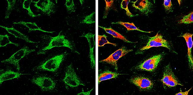 Calnexin Antibody in Immunocytochemistry (ICC/IF)