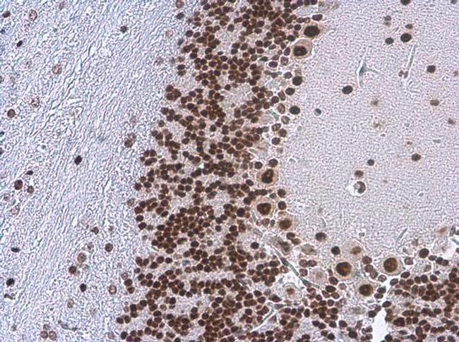 TDP-43 Antibody in Immunohistochemistry (Paraffin) (IHC (P))