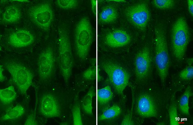 MEK2 Antibody in Immunocytochemistry (ICC/IF)