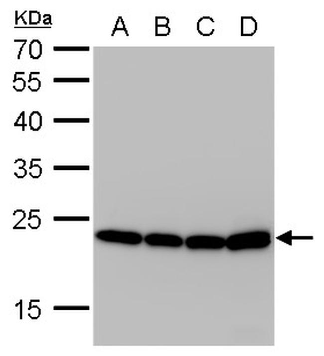 SOD2 Antibody in Western Blot (WB)