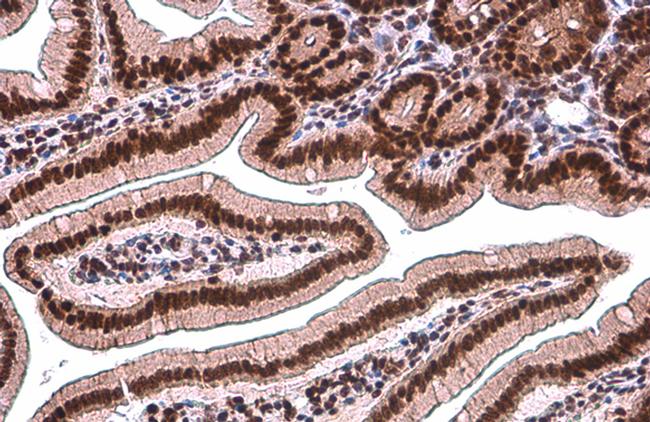 TDG Antibody in Immunohistochemistry (Paraffin) (IHC (P))