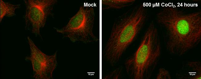 HIF-2 alpha Antibody in Immunocytochemistry (ICC/IF)