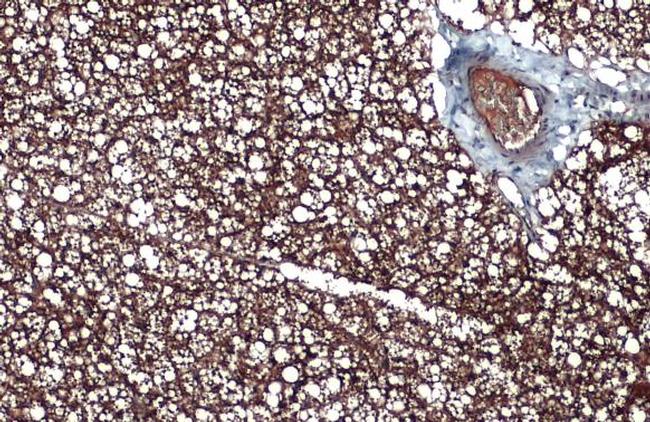 UCP1 Antibody in Immunohistochemistry (Paraffin) (IHC (P))