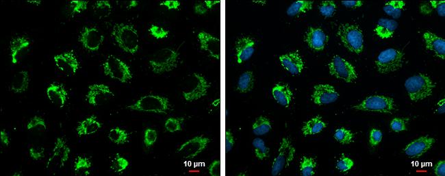 Glutaminase C (GAC) Antibody in Immunocytochemistry (ICC/IF)