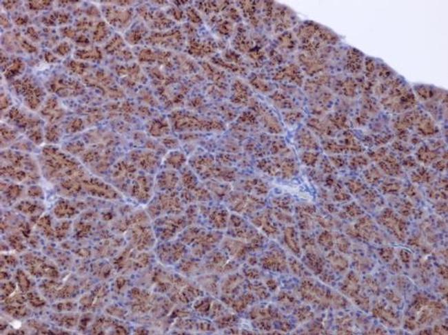 ACSL4 Antibody in Immunohistochemistry (Paraffin) (IHC (P))