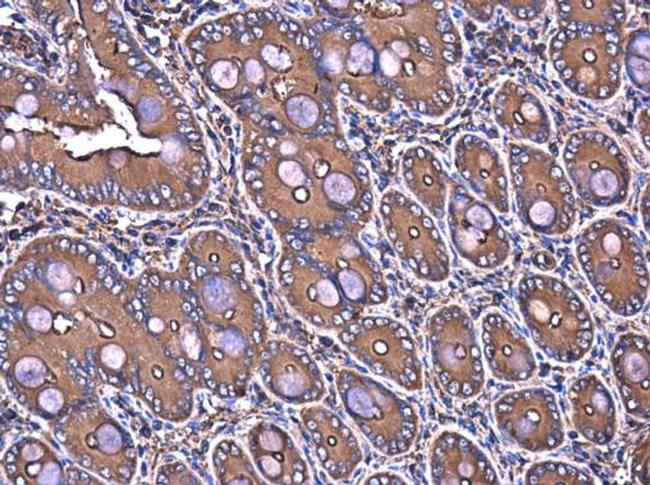 Filamin B Antibody in Immunohistochemistry (Paraffin) (IHC (P))